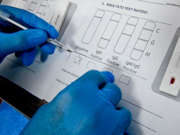 У десяти медзакладах Волині розпочнуть тестувати на коронавірус новим методом