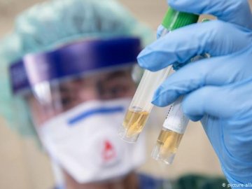 Волинське місто надіслало до лабораторії майже 100 зразків аналізів на коронавірус