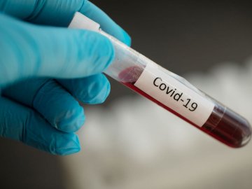 Три смерті і 80 нових випадків: ситуація з коронавірусом на Волині за останню добу