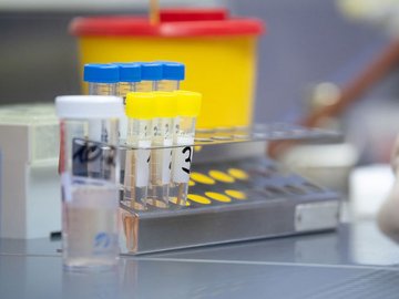 14 медзакладів на Волині проводять ІФА-тести на коронавірус