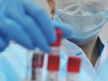 Одна смерть і 148 нових випадків: ситуація з коронавірусом на Волині станом на 18 жовтня 