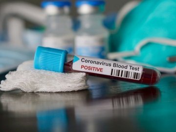 240 нових випадків та 5 смертей: ситуація з коронавірусом на Волині за минулу добу