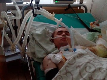 Хворий лучанин впав на газову плиту: родина благає про допомогу в лікуванні опіків