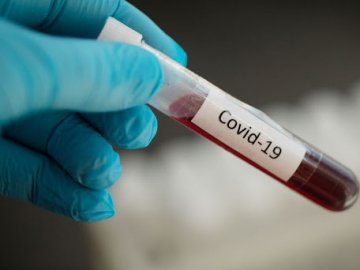 В Україні виявили найменшу добову кількість нових випадків COVID-19 з вересня