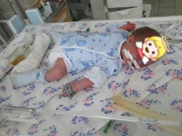 Волинян просять допомогти новонародженому, який не може самостійно дихати