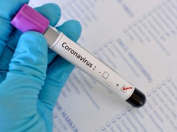 Коронавірус в Україні: все, що відомо про інфікованого чоловіка