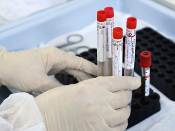 Три смерті і 264 нових хворих: ситуація з коронавірусом на Волині за минулу добу