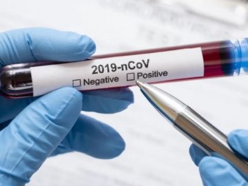 За добу – 8 хворих: де на Волині виявили нові випадки коронавірусу станом на ранок 2 травня