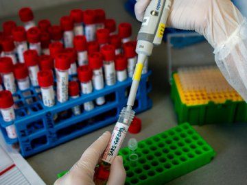 В Україні – понад 5 тисяч нових інфікованих коронавірусом, виявлених за добу, на Волині – 112 