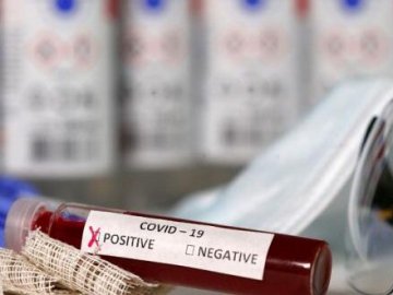 Ранок 1 листопада: в Україні за добу виявили 7 959 випадків коронавірусу, на Волині – 230