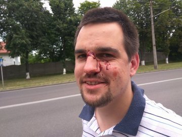 Поліція розслідує побиття керівника осередку «НацКорпусу» у Луцьку