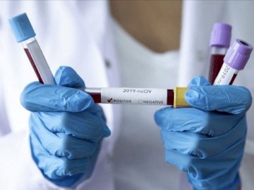 П'ятнадцять смертей і 322 нові випадки: ситуація з коронавірусом на Волині за добу
