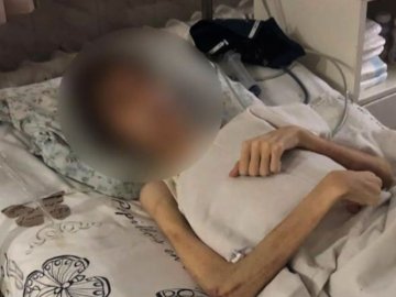 9 років лікував від «нечистого»: в Одесі батько довів власного сина до анорексії