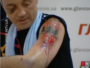 Татуювання «Слава Україні!» терористи зрізали розбитою лампочкою. ФОТО