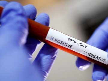 В одному з районів Волині виявили 2 нових випадки коронавірусу