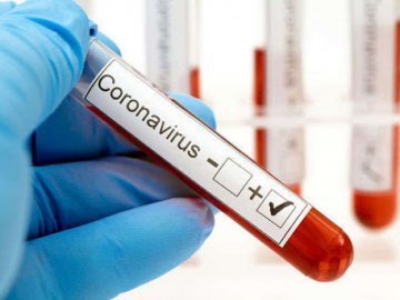 Відомо, скільки хворих на коронавірус виявили в Україні за останню добу