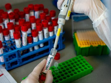 Ранок 7 листопада: в Україні за добу виявили 10 746 випадків коронавірусу, на Волині – 482