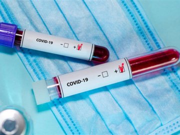 Україна встановила антирекорд нових випадків COVID-19: за добу  – 689 інфікованих, а на Волині – 52