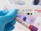 Лікарка-інфекціоністка пояснила, чому тести на коронавірус «помиляються»