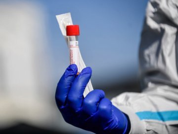 Одна смерть і 129 нових випадків: ситуація з коронавірусом на Волині за минулу добу