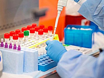 Рожищенська районна лікарня робитиме ІФА-тести на коронавірус