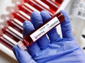 Коронавірус на Волині: де зафіксували 216 нових випадків за добу