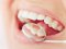 Науковці довели, що погано почищені зуби і захворювання ротової порожнини підвищують ризик ускладнень COVID-19