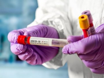 4 смерті та 182 нових випадки: ситуація з коронавірусом на Волині за минулу добу