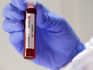 Дві смерті і 65 нових хворих: ситуація з коронавірусом на Волині за останню добу