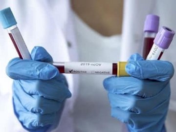 За добу на Волині – 2 нові випадки коронавірусу: де зафіксували інфекцію