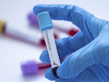 В Україні – новий рекорд із кількості випадків коронавірусу
