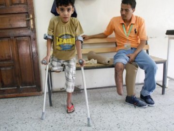 Дорожче коштувало: український лікар направив на ампутацію десятки людей в Ємені