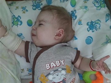 5 операцій за 11 місяців життя: малюк, хворий на гідроцефалію, потребує допомоги