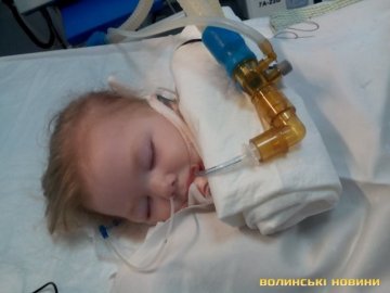 2-річна дівчинка з Луцька, яку паралізувало через двобічну пневмонію, бореться за життя