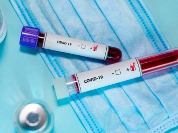 В Україні за минулу добу – 6 113 випадків коронавірусу