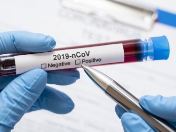 У МОЗ пояснили причини затримки результатів тестів на коронавірус