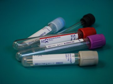 Дві смерті і 72 нових випадки: ситуація з коронавірусом на Волині за останню добу