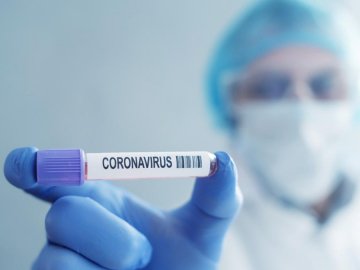 Одна смерть і 54 нових випадки: ситуація з коронавірусом на Волині станом на 7 серпня 