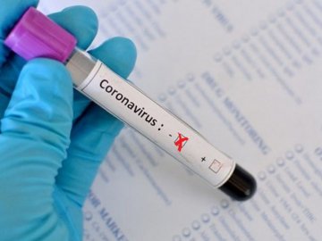 Повідомили результати тесту на COVID-19 cвященників, які відспівували інфікованого луцького лікаря-гінеколога