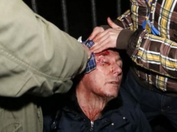 Луценко був п’яний, його побили мітингувальники, ‒ міліція. ВІДЕО