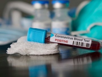 Поліція відкрила «кримінал» через інфікування коронавірусом працівників луцької лікарні