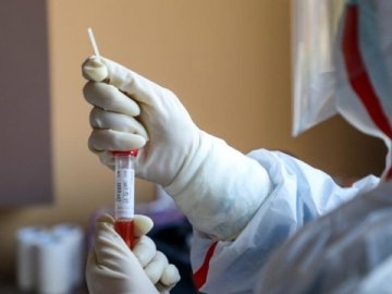 Степанов пояснив, чому ПЛР-тести показують негативний результат у 30% інфікованих коронавірусом 