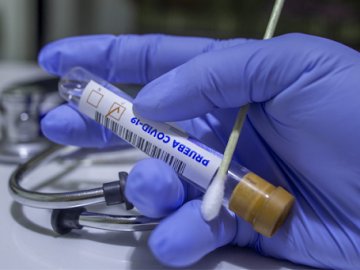 415 нових хворих і 9 смертей: ситуація з коронавірусом на Волині за останню добу