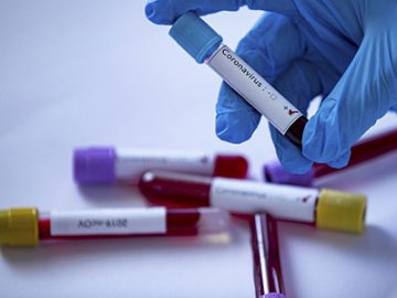 10 смертей та 429 нових хворих: ситуація з коронавірусом на Волині за останню добу