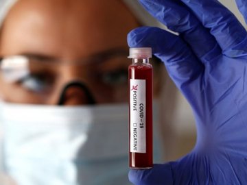 На Волині за добу – 7 нових випадків коронавірусу 