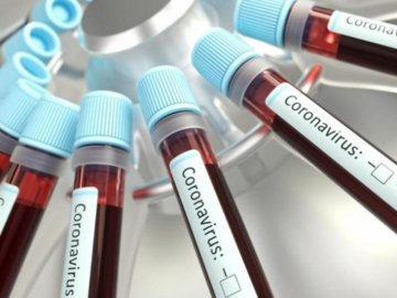 На Волині –  новий випадок коронавірусу