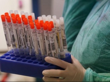 Повідомили кількість нових інфікованих коронавірусом в Україні за останню  добу