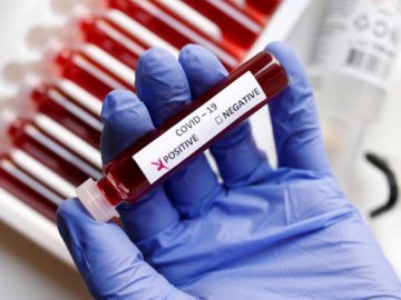 4 смерті і 308 нових випадків: ситуація з коронавірусом на Волині за останню добу