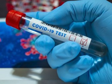 Найбільше за весь час пандемії: в Україні – 921 новий випадок коронавірусу за добу, на Волині – 63