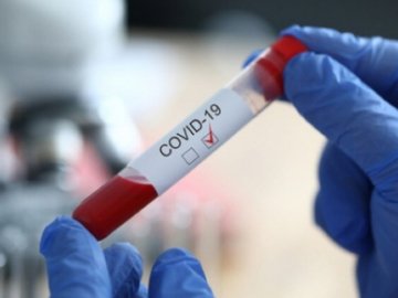 357 нових випадків та 3 смерті: яка ситуація з коронавірусом на Волині за останню добу